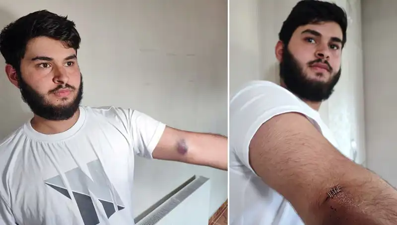 Bahçeye Kaçan Top, Mahalleyi Hareketlendirdi: Conolar Kamyonetle Geldi!