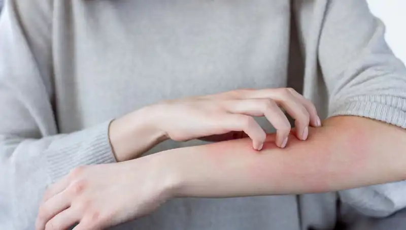 Dermatologdan Çarpıcı Açıklama: Gözden Kaçan Cilt Kanseri Belirtileri